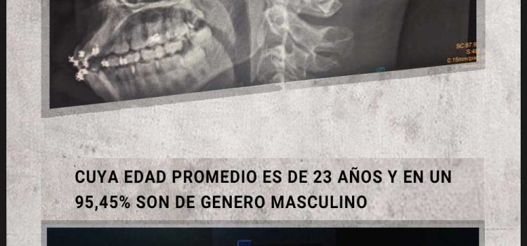 Observatorio DDHH-ULA determinó disparos a los ojos como patrón de actuación de la fuerza pública.